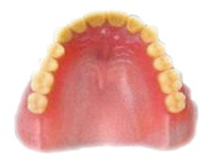 レジン床の義歯2
