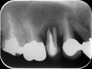 306.jpgのサムネール画像のサムネール画像