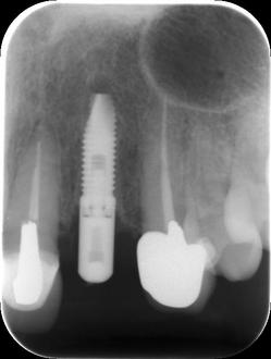 0000003687_IntraOral_20130115162513.jpg