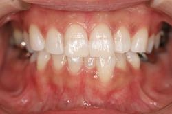 0000004230__IntraOral_20120809162244.jpg