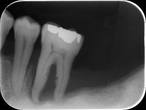 0000003804__IntraOral_20120811095733.jpg