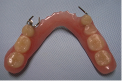 レジン床の義歯1